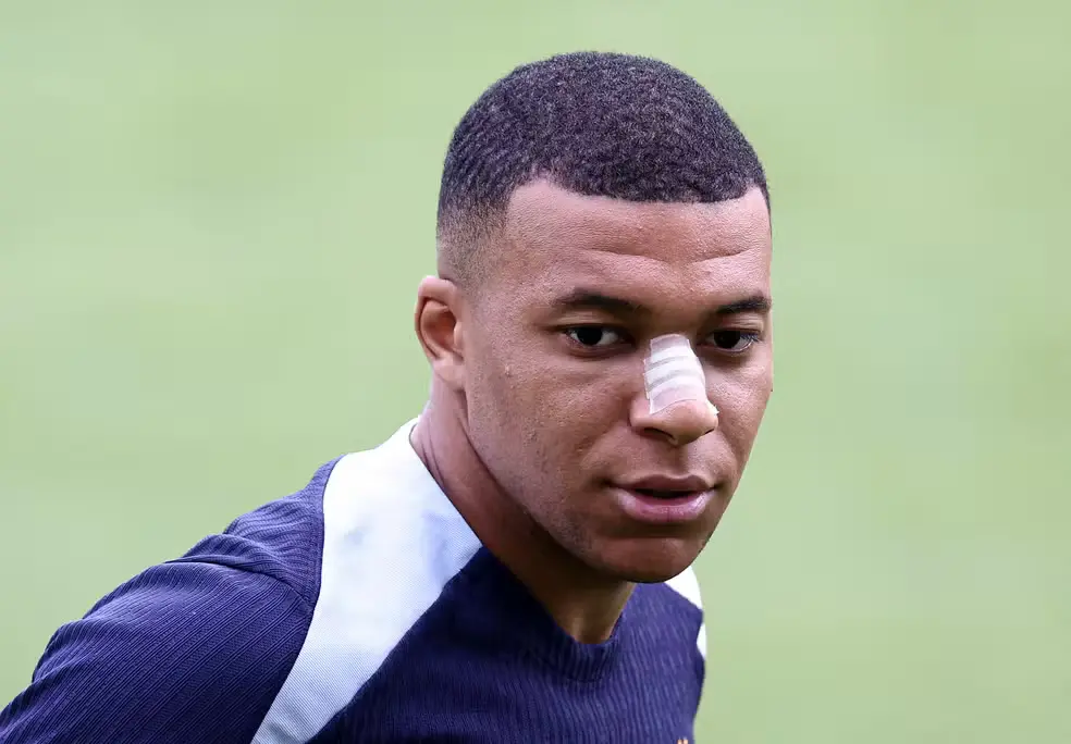 Mbappé bị gãy mũi