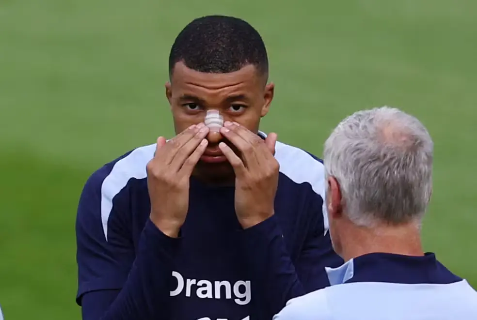 Mbappé với miếng băng trên mũi